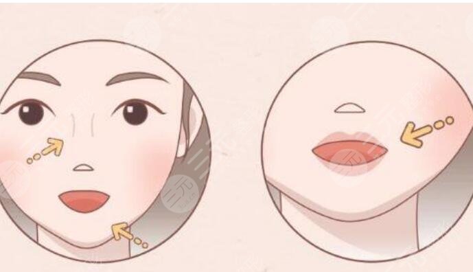 丰唇