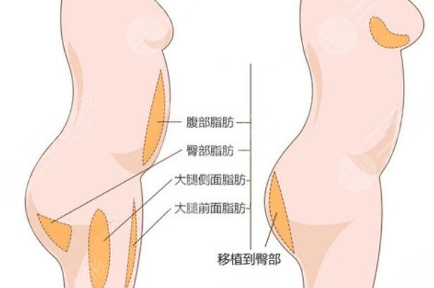丰臀