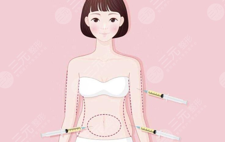 腰腹吸脂