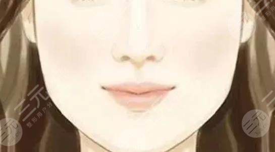 面部吸脂