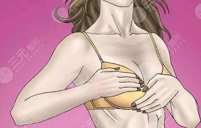 乳房下垂矫正