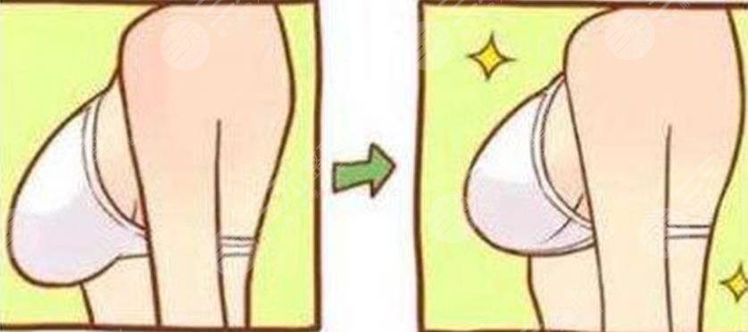 悬吊