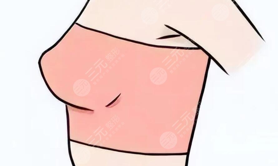 悬吊