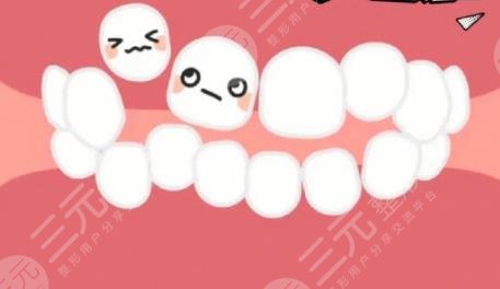 牙齿矫正