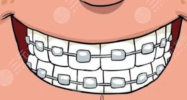 牙齿矫正