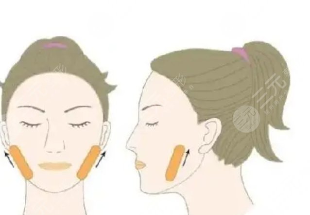 下颌角