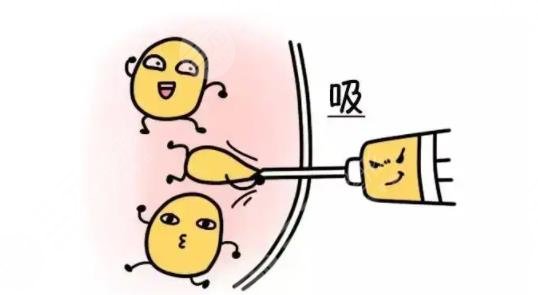 吸脂