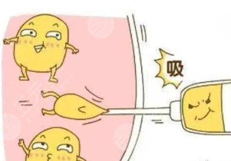 吸脂