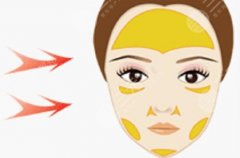 南京鼓楼医院自体脂肪填充价格贵不贵？效果好不好？口碑评价来袭