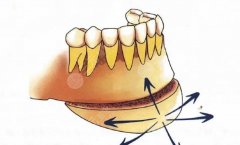 颏成型适合什么人做？下巴后缩是隆下巴还是颏成型？
