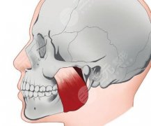 下颌角加颏成型手术好不好？手术后恢复期会延长吗？