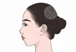 正颌