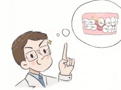 偏颌正畸可以吗？做正畸整形术后该怎么护理？