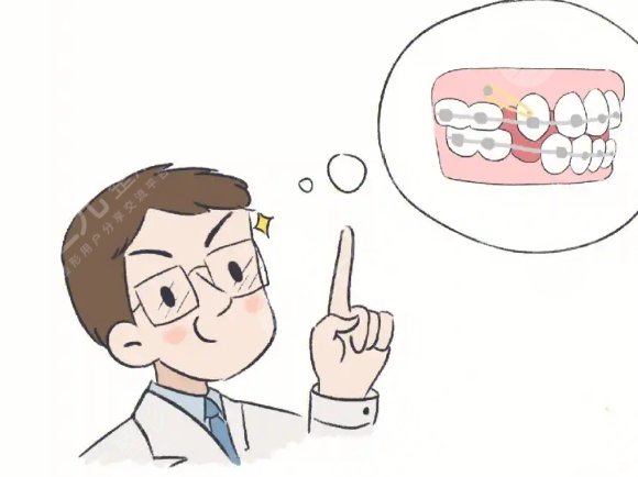 偏颌正畸