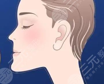 正颌手术