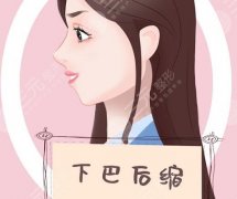 下巴后缩玻尿酸危害有哪些？看完这些在决定做不做！来看详细介绍