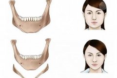 西京医院整形外科哪个医生好？马显杰、澎湃凭实力上榜！