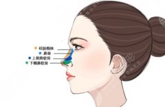 半肋鼻综合可以撑几年？半肋鼻综合和全肋鼻综合有什么区别？