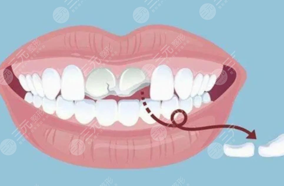 牙齿矫正