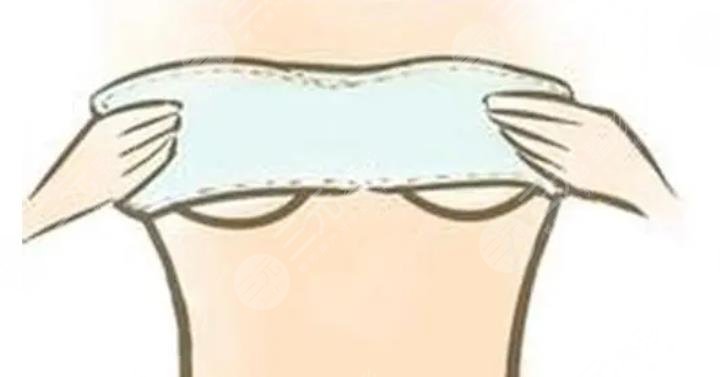 隆胸