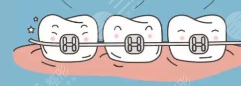 牙齿矫正