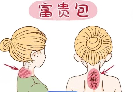 富贵包