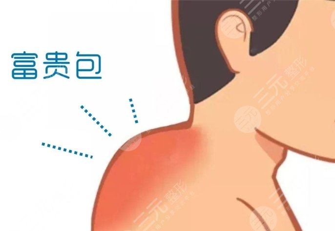 富贵包