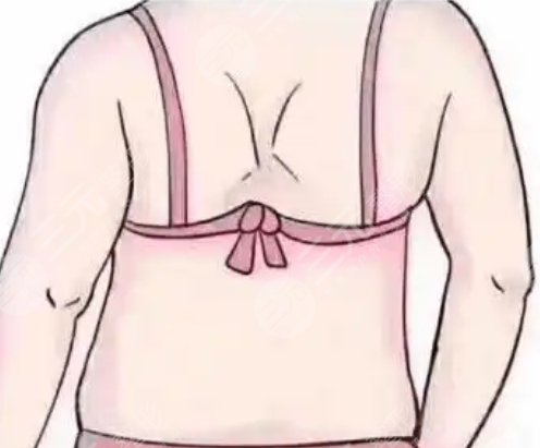 吸脂