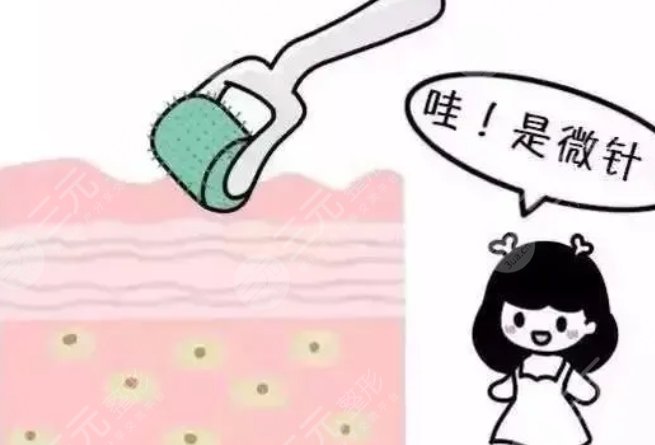 滚轮微针