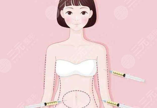 腰腹吸脂