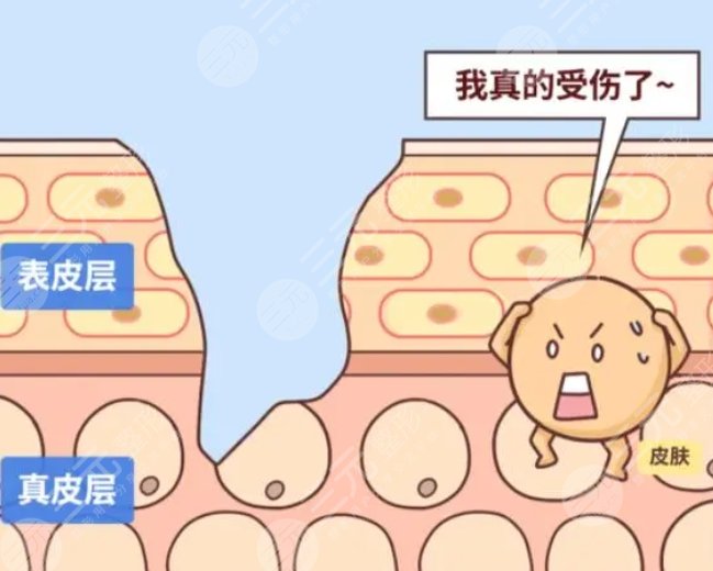 疤痕