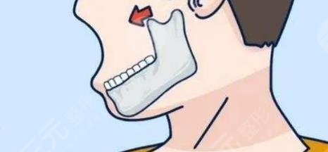 磨骨