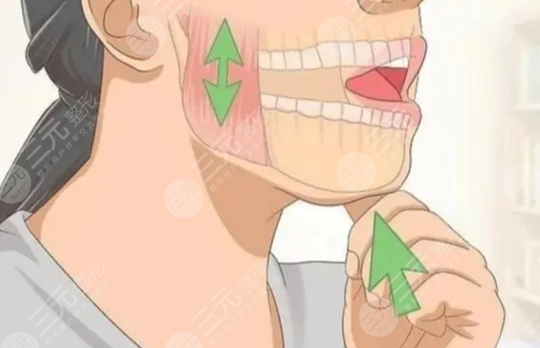 下颌角