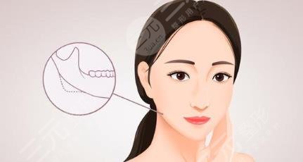 下颌角