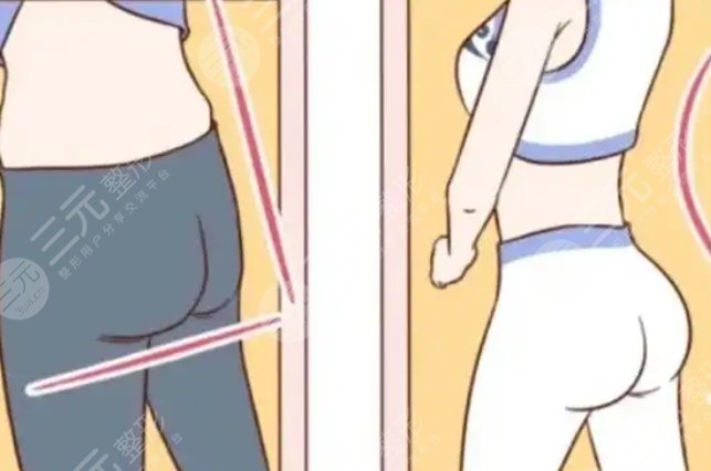 提臀