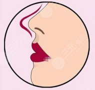 鼻综合整形的真实案例分享！原理是什么？