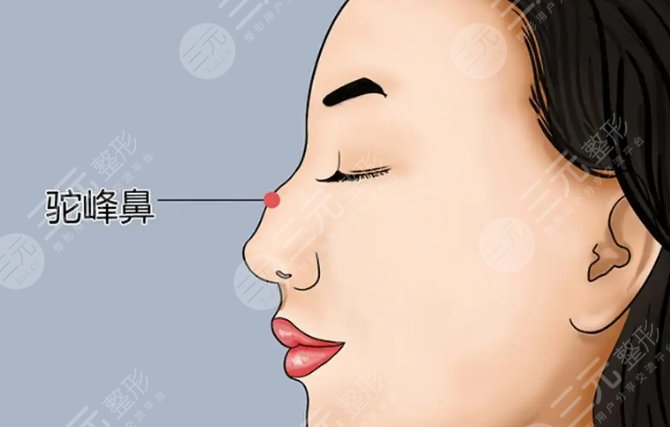 驼峰鼻动漫