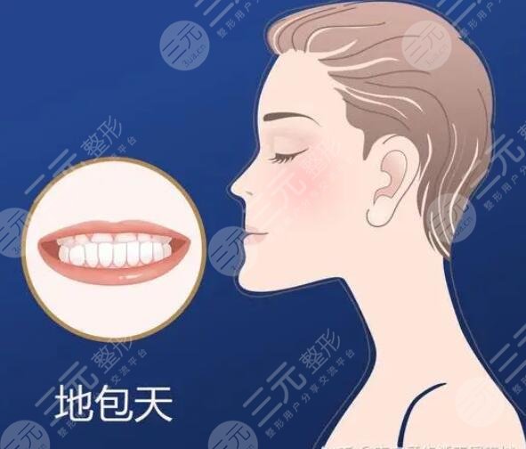 地包天