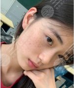嘉兴荣军医院美容科激光祛斑多少钱?激光祛斑的参考价格在1890元起 嘉兴荣军医院美容科激光祛斑多少钱?激光祛斑的参考价格在1890元起