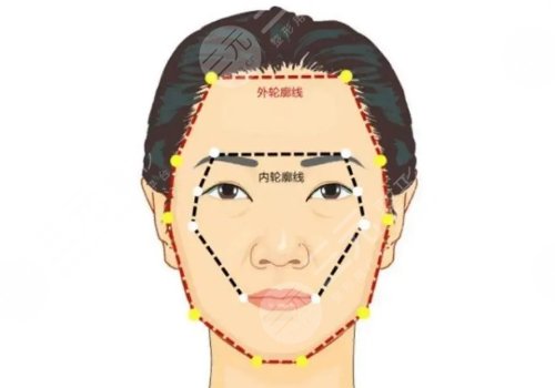 北京协和医院夏泽楠医生脸部整形怎么样