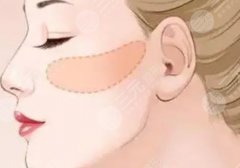 上海磨骨手术费价格表一览!戳进来看当地实力派医院基本信息! 上海磨骨手术费价格表一览!戳进来看当地实力派医院基本信息!
