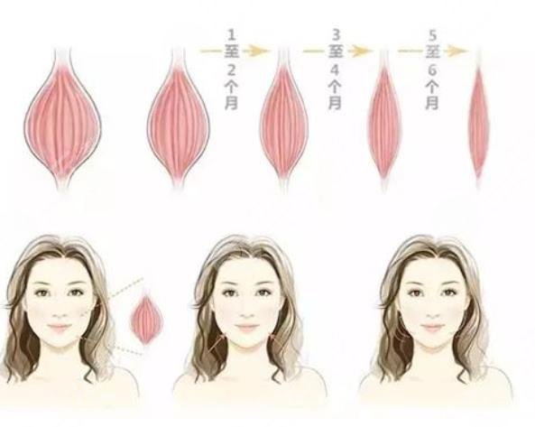 瘦脸