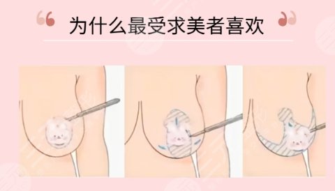缩胸