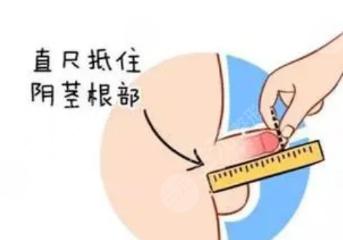2025长春哪里延长术做得好