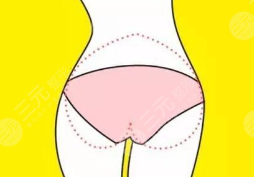 邝石峰医生脂肪填充案例