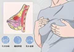 武汉叶子隆胸医生排名如何?吴明瑞医生值得选择 武汉叶子隆胸医生排名如何?吴明瑞医生值得选择