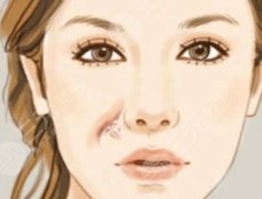 宁波六院去疤痕多少钱?院内周丹亚医生人气颇高! 宁波六院去疤痕多少钱?院内周丹亚医生人气颇高!