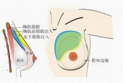 哈尔滨隆胸专家排行榜推荐|戳进来看医生选择小经验! 哈尔滨隆胸专家排行榜推荐|戳进来看医生选择小经验!