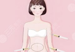 2025昆明注射隆胸多少钱？从2.3万元起！附有三家医院资料以及评价