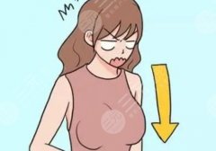 孙湄扬做悬吊手术加假体的实践多吗？挺丰富的！内附真人案例！